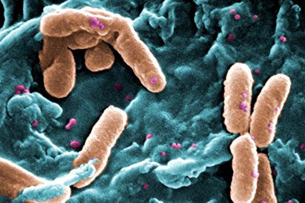 UCLA 연구팀은 녹농균 연구를 통해 박테리아는 ‘기억’을 가지며, 더불어 해당 기억을 다음세대에 전달해줄 수 있다는 사실을 발견했다. 위는 녹농균 사진이다. | US Centers for Disease Control and Prevention