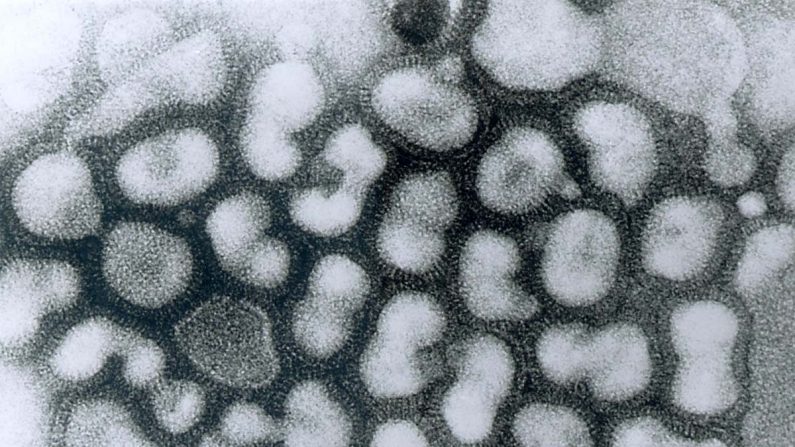 인플루엔자 바이러스 현미경 사진 | CDC/Dr. Erskine Palmer 