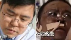 코로나19 환자 치료하다 얼굴 검게 변했던 중국 우한병원 의사, 끝내 숨졌다