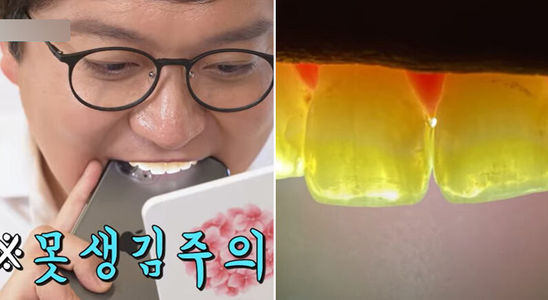유튜브 채널  '치대남_치과의사 고광욱_Dentist'