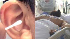 매일 면봉으로 귀 청소하다가 ‘두개골 감염’돼 목숨 잃을 뻔한 30대 여성