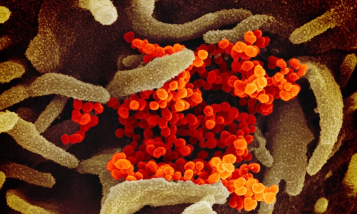 실험실에서 배양된 세포(녹색) 표면에서 중공 바이러스(코로나19)가 나오는 모습을 나타낸 전자 현미경 이미지 | NIAID-RML