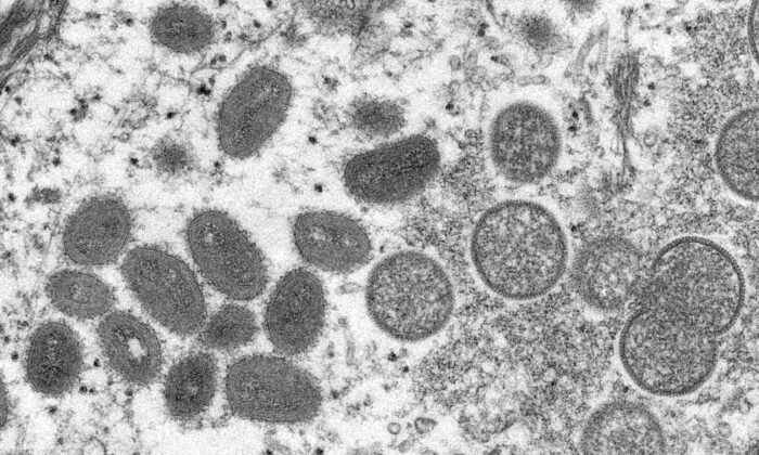 전자현미경(EM) 이미지: 타원형의 성숙한 원숭이두창 바이러스와 미성숙한 바이러스를 보여준다. 2022.5.18 | 로이터=연합뉴스