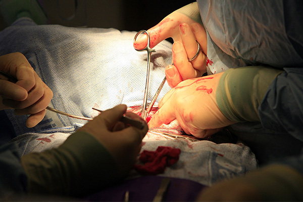 장기이식 수술을 진행하고 있는 의사 | Christopher Furlong/Getty Images
