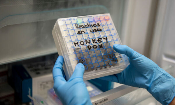 스페인 마드리드의 한 의료센터 연구원이 원숭이두창 감염자 샘플을 들고 있다. | Pablo Blazquez Dominguez/Getty Images