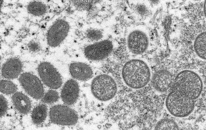 원숭이두창 바이러스 | 미국 질병통제예방센터(CDC)