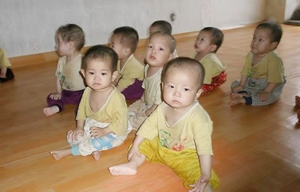 영양실조에 걸린 북한 어린이들 | 연합뉴스