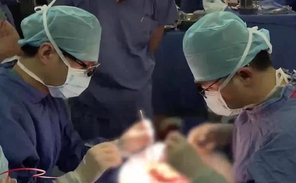 기사와 직접 관련 없는 중국 의료진 수술 장면 | CCTV 화면 캡처