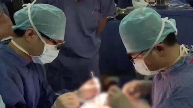 中 공산당 ‘중앙아 껴안기’…키르기스스탄 아동에 무료 심장수술